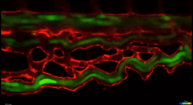 with green erythrocytes and red blood vessels, submitted by e
