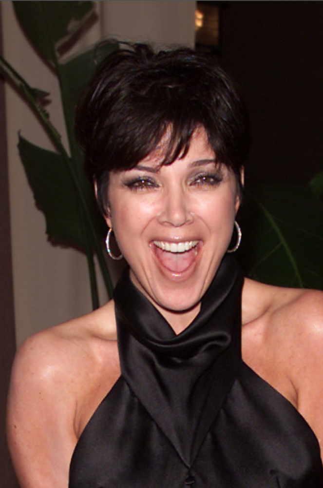 Kris Jenner Facelift Lawsuit Gets Ugly As Kardashian Mom Countersues Huffpost 3103