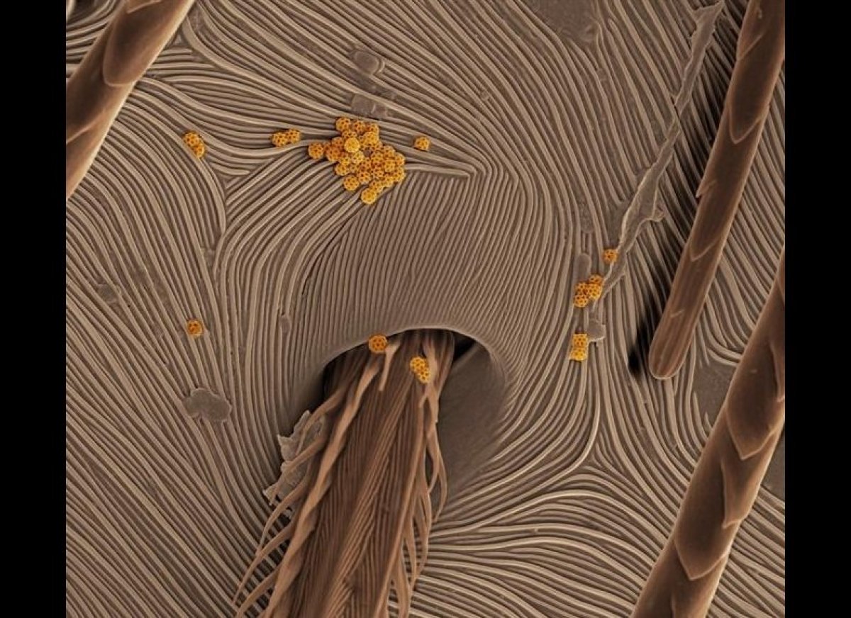 Electron Microscope Photos Show Spider Skin, Coffee, Dandelions, Tomato