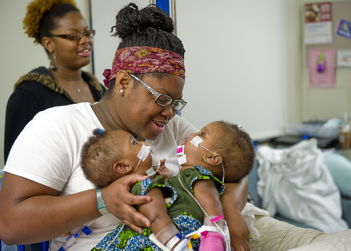 Kendra And Maliyah Herrin, Formerly Conjoined Twins, Thriving 7 Years
