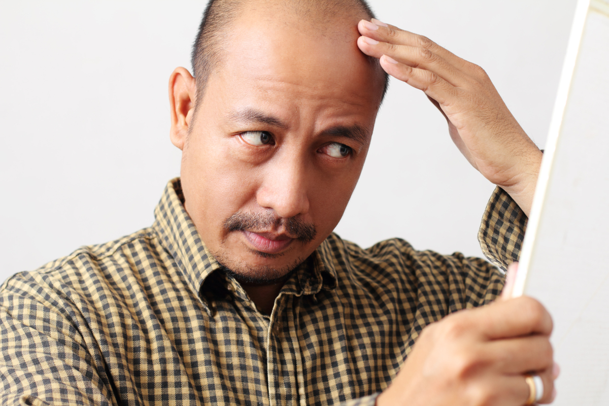 Why Do People Go Bald Video Tackles Hair Loss Head On HuffPost