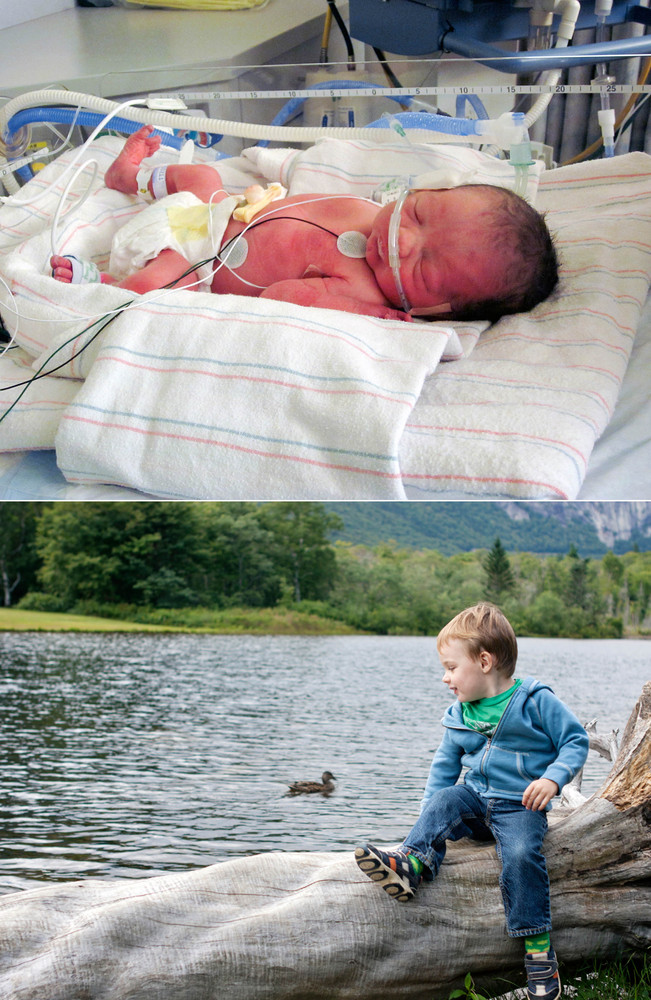 Meet 51 Babies Who Were Born Too Soon -- And See How Far ...