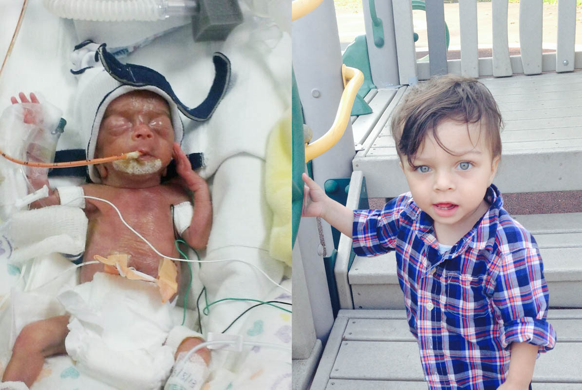 Meet 51 Babies Who Were Born Too Soon And See How Far