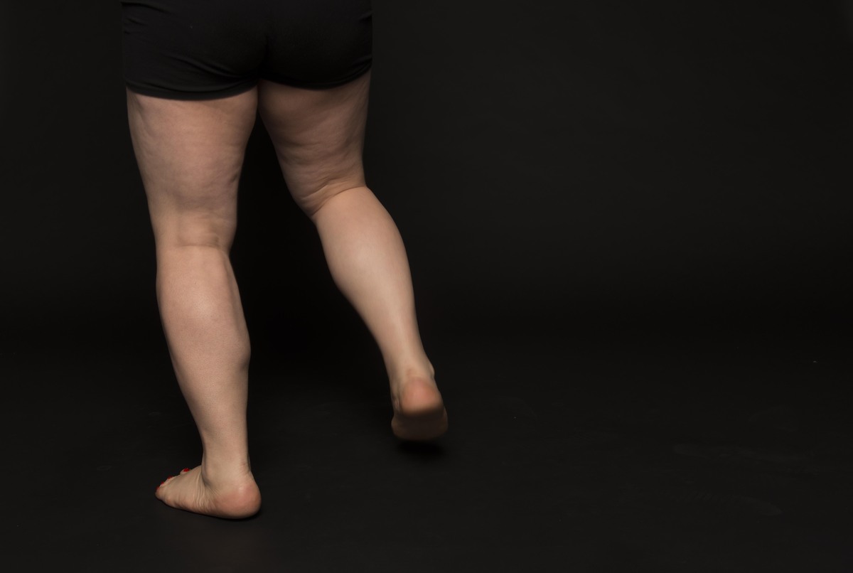 Women Bare Their Gloriously Unretouched Thighs And Describe Them In One Word Huffpost