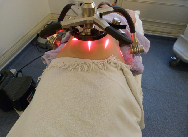 Image result for fat laser treatment