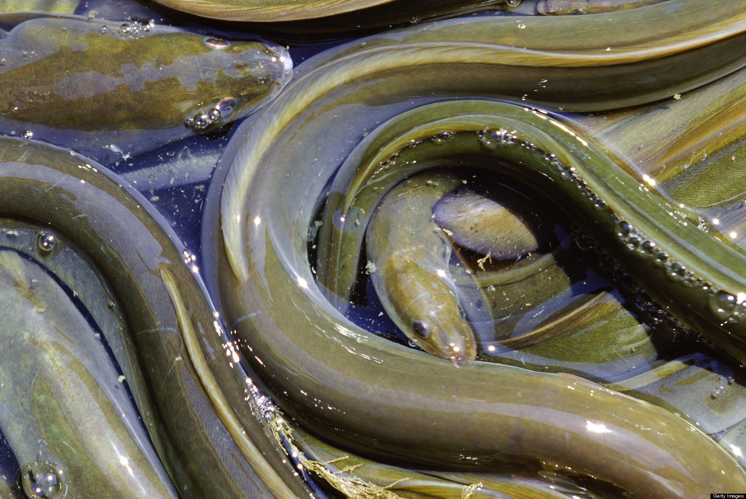 Eel Removed From Man After Getting Stuck Chewing Through Colon