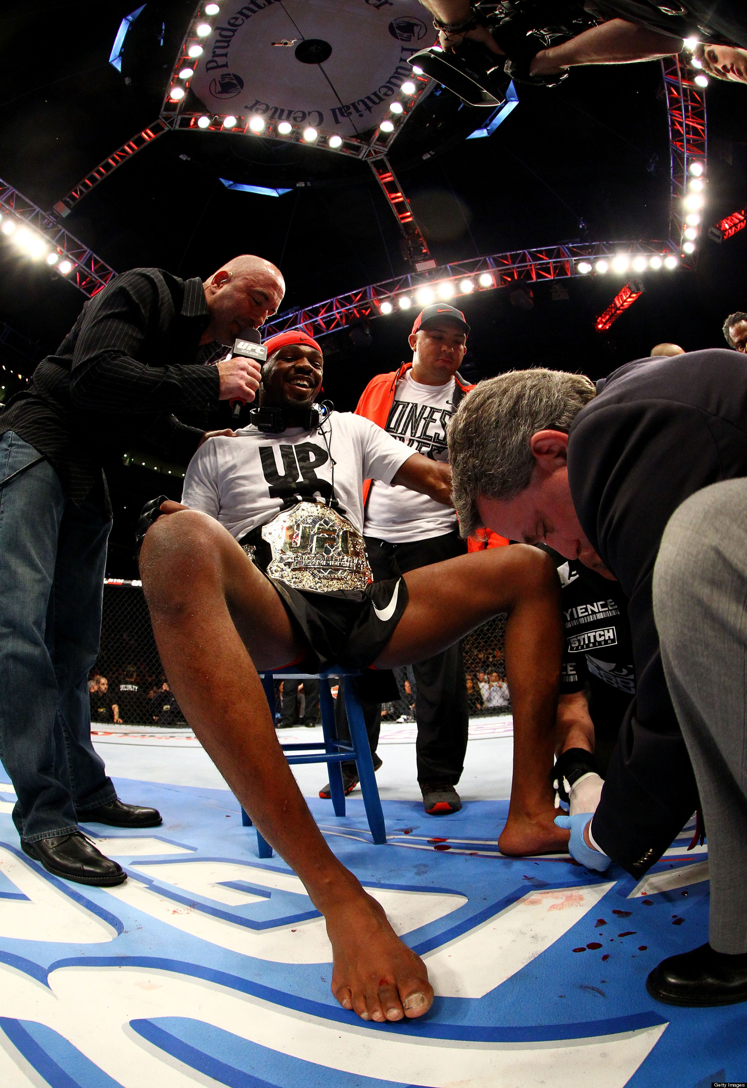 Jon Jones Toe Injured In Win Over Chael Sonnen At UFC 159 (PHOTO ...