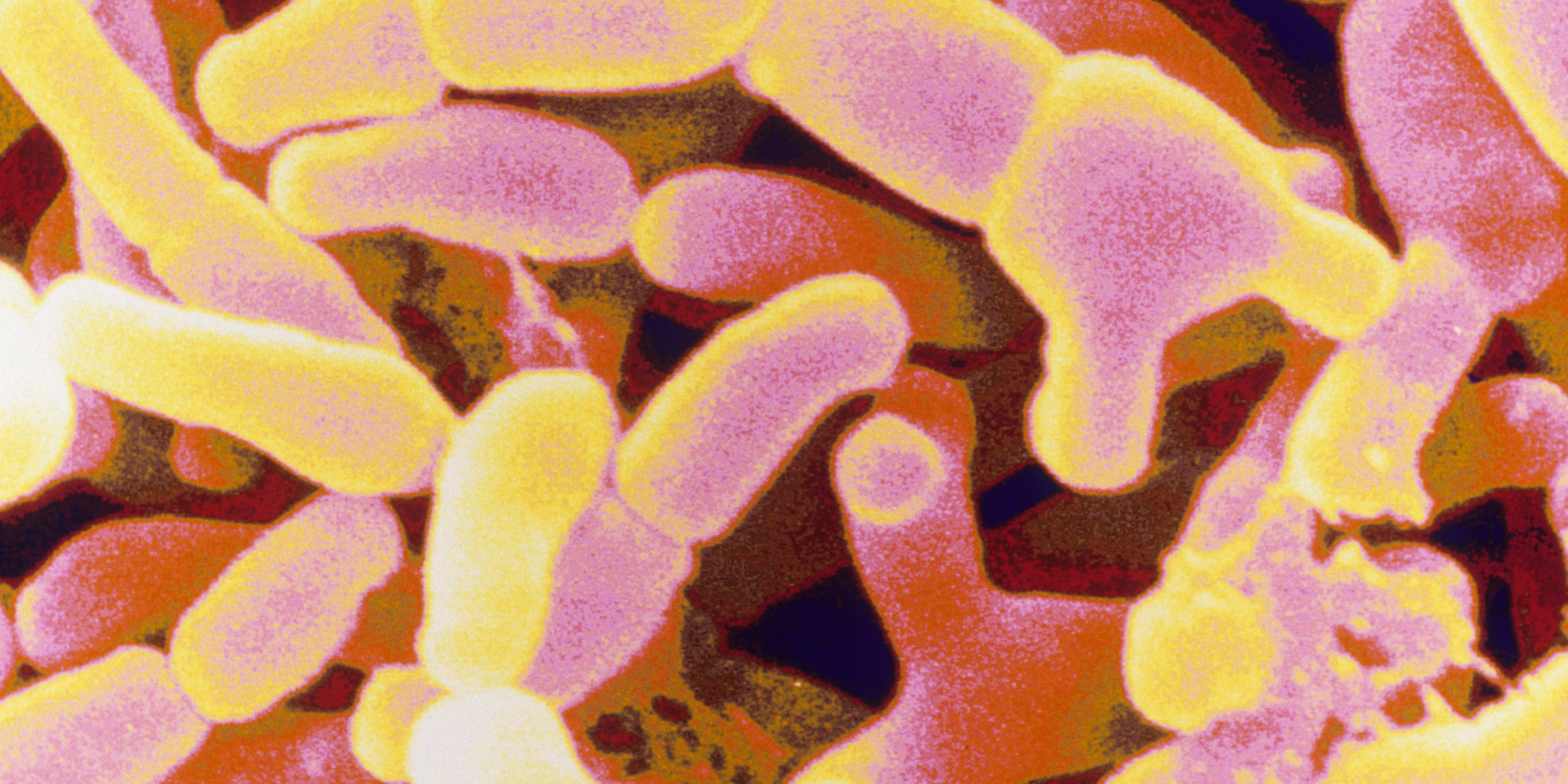 Probiotics Could Help Protect Against Antibiotic-Related Diarrhea