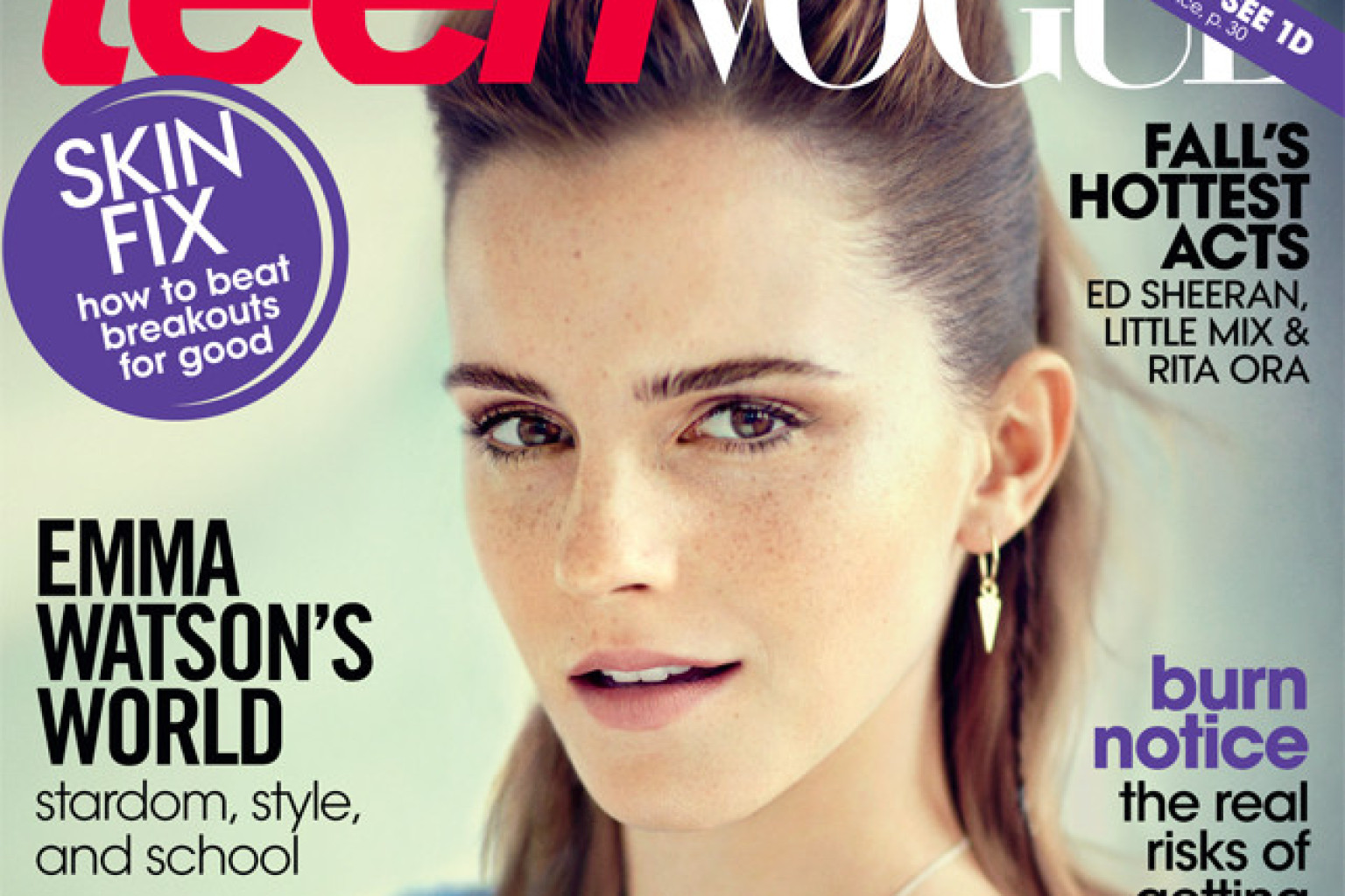 Emma Watson's Hair In Teen Vogue Is Throwing Us For A Loop 