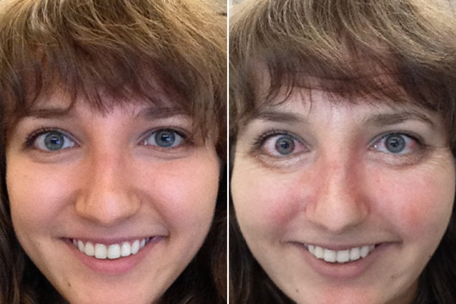 Drinking Mirror App Shows Us What Alcohol Does To Our Skin PHOTOS Drinking Mirror App Shows Us What Alcohol Does To Our Skin PHOTOS