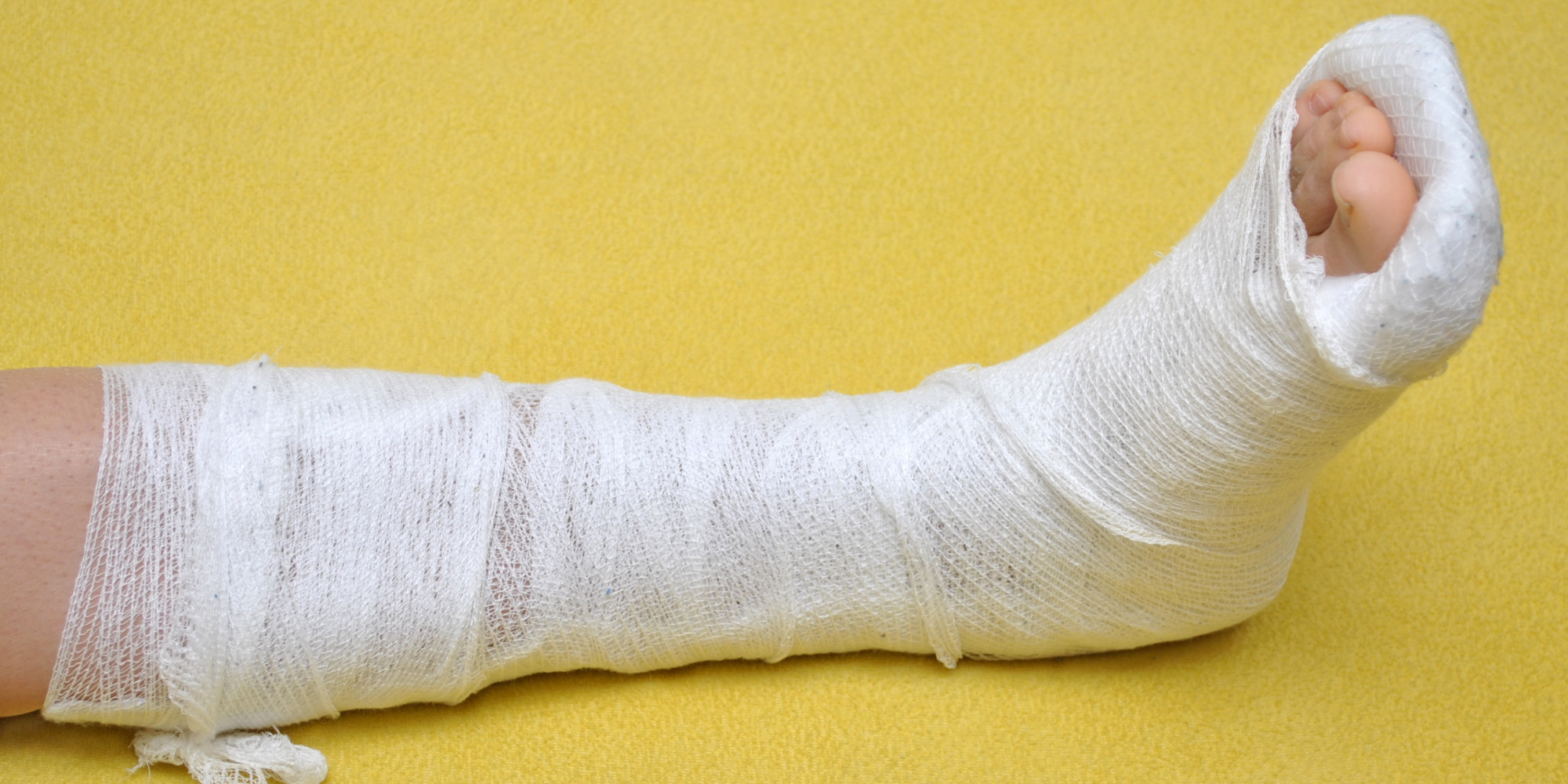 when-to-fix-a-broken-ankle-huffpost