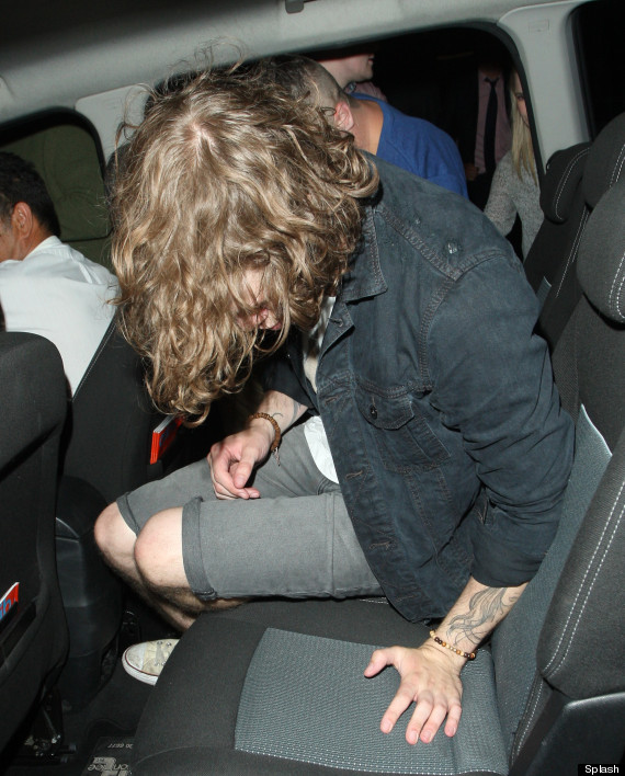 The Wanteds Jay Mcguiness Looks A Little Worse For Wear After 
