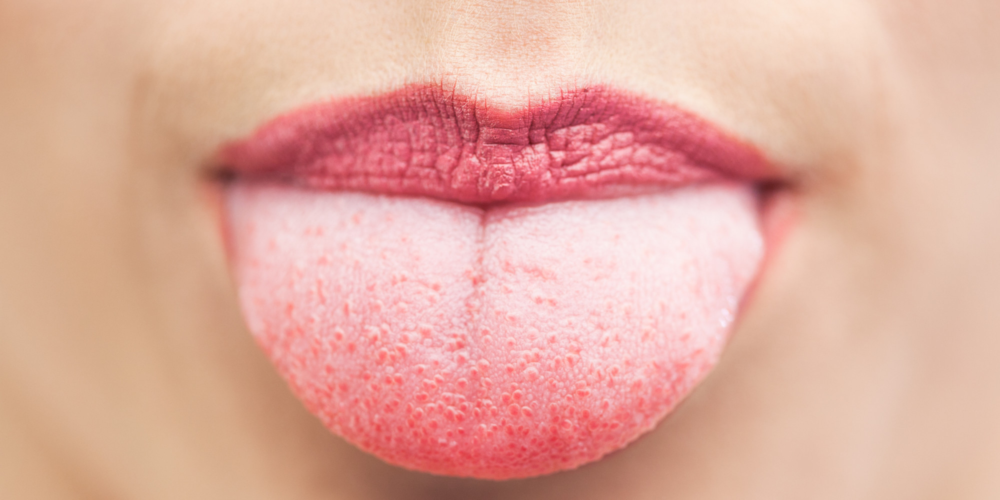 Dr Oz What The Color Of Your Tongue Can Tell You About Your Health Huffpost 6829