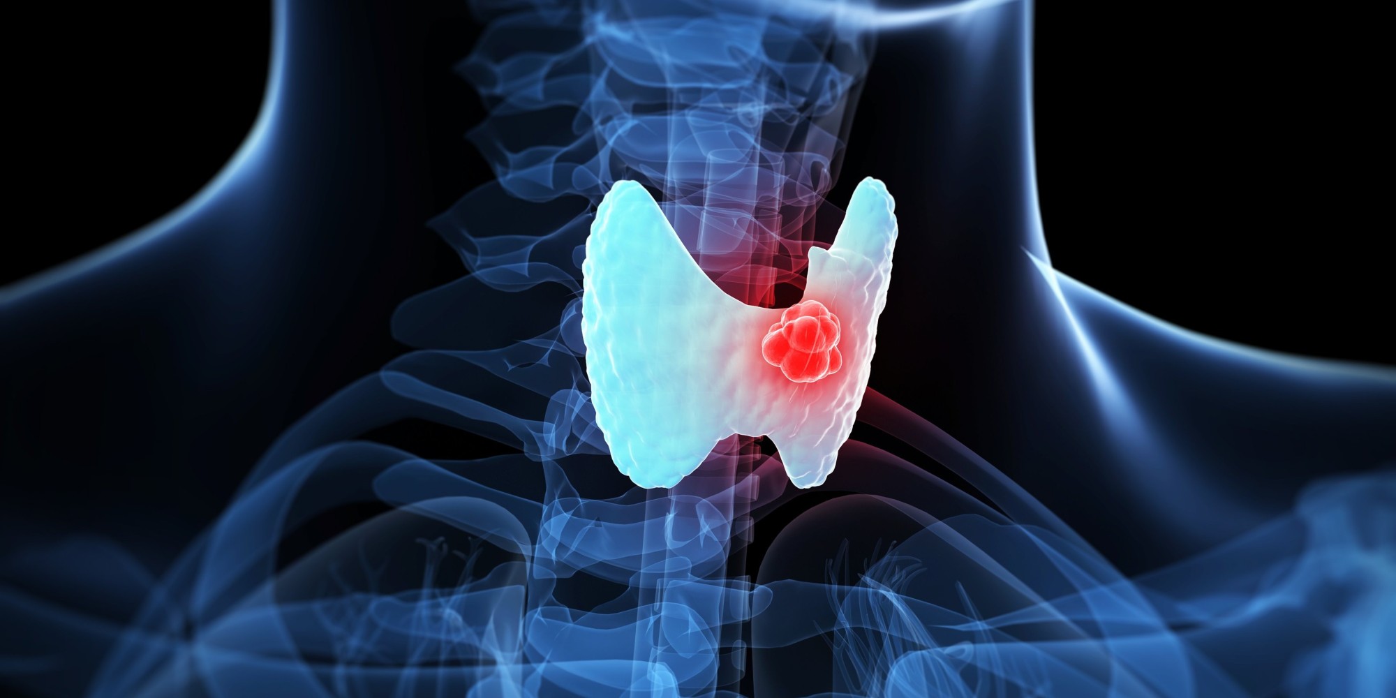 Tired Check Your Neck For Thyroid Cancer Huffpost