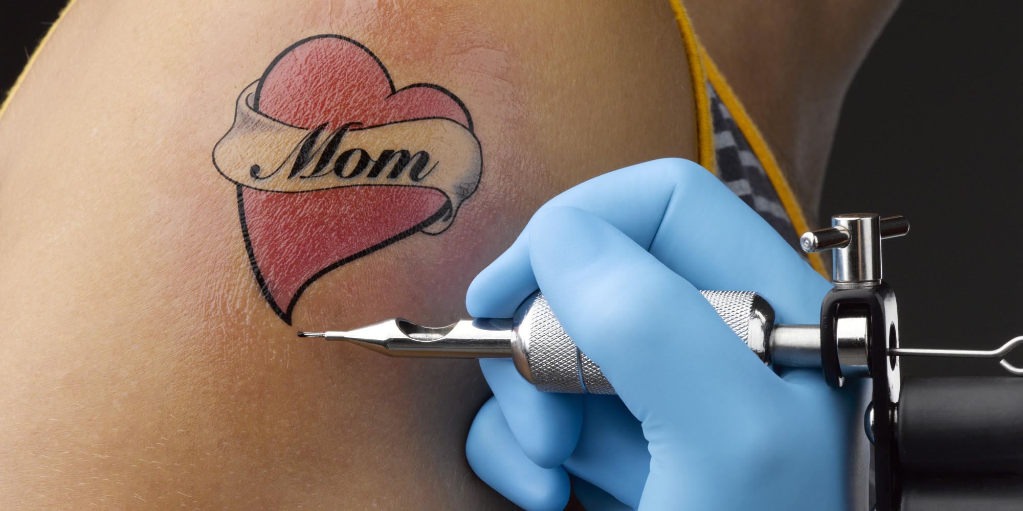 TattooRemoval Program Aims To Help City Combat Its High