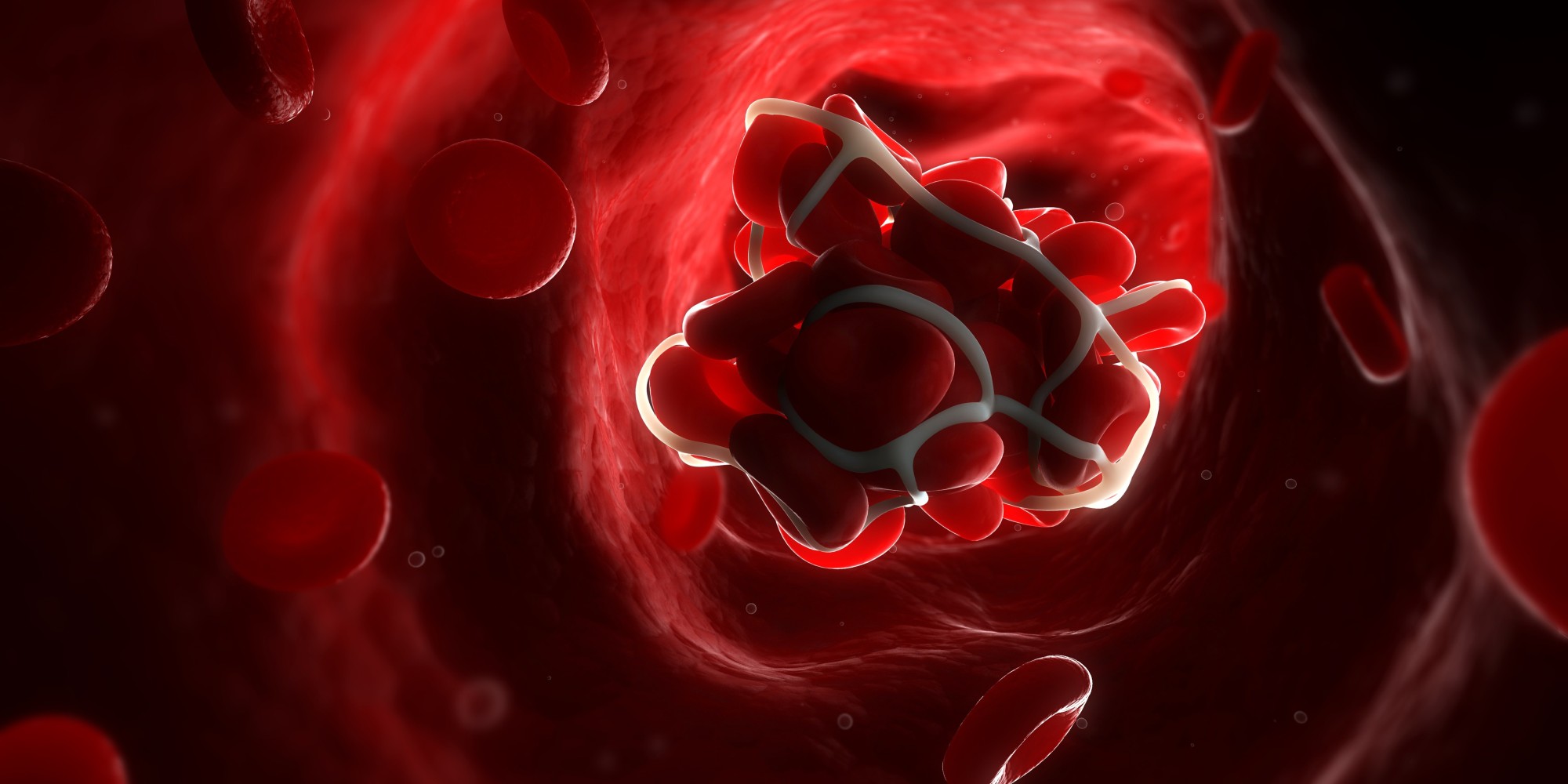 Test To Detect Hidden Blood Clots On The Horizon HuffPost