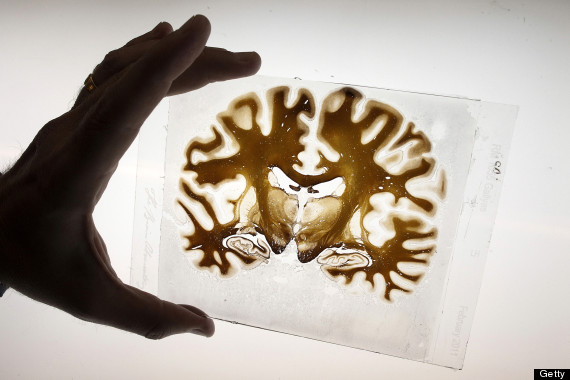 human brain