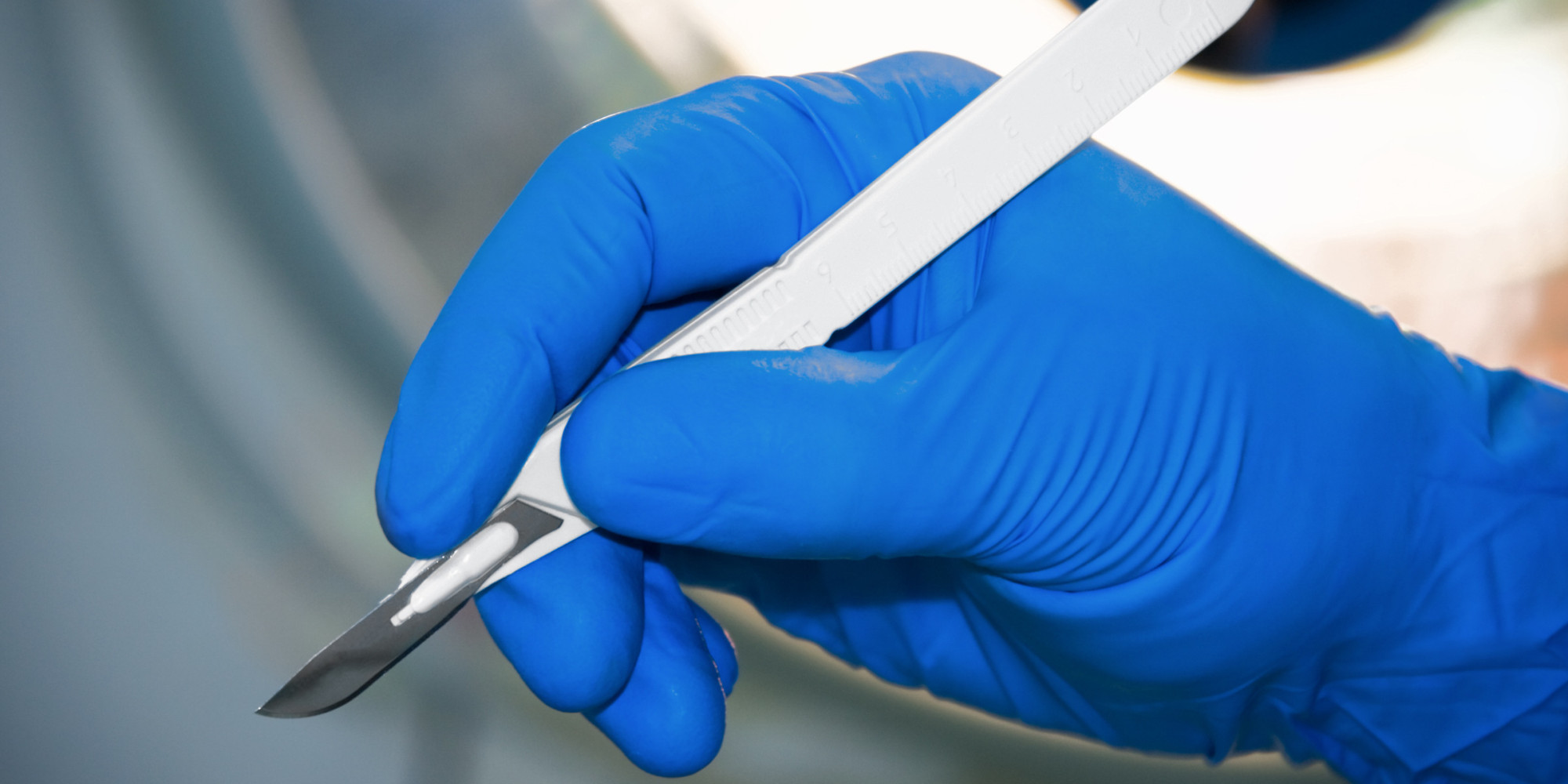 New Ligament In Human Knee Discovered By Surgeons In Belgium (PHOTO