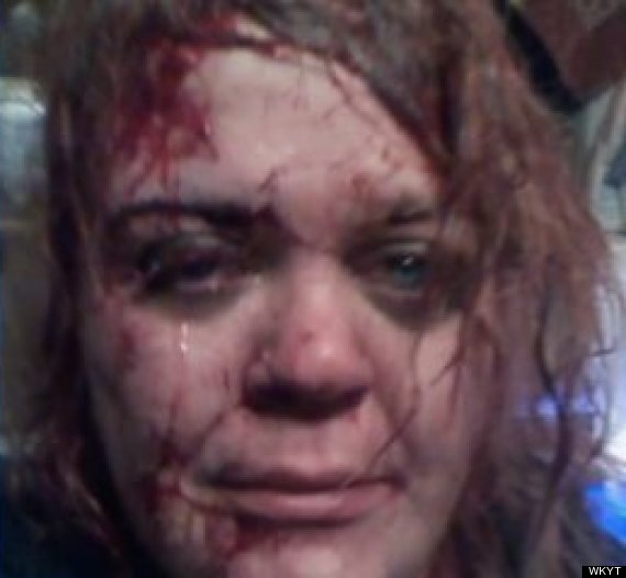 Facebook Selfie Saves Battered Woman S Life Picture Huffpost Uk