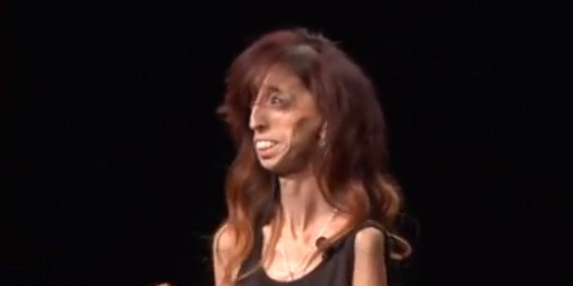 labeled-world-s-ugliest-woman-motivational-speaker-turns-hate-into