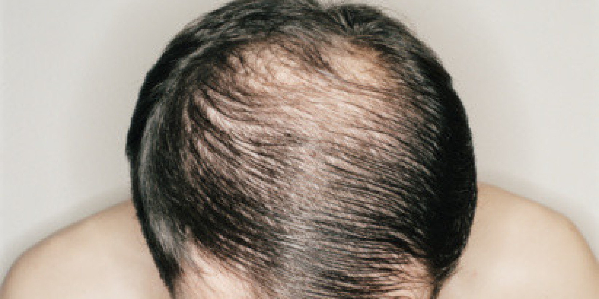 5 Habits That Are Making You Lose Hair HuffPost