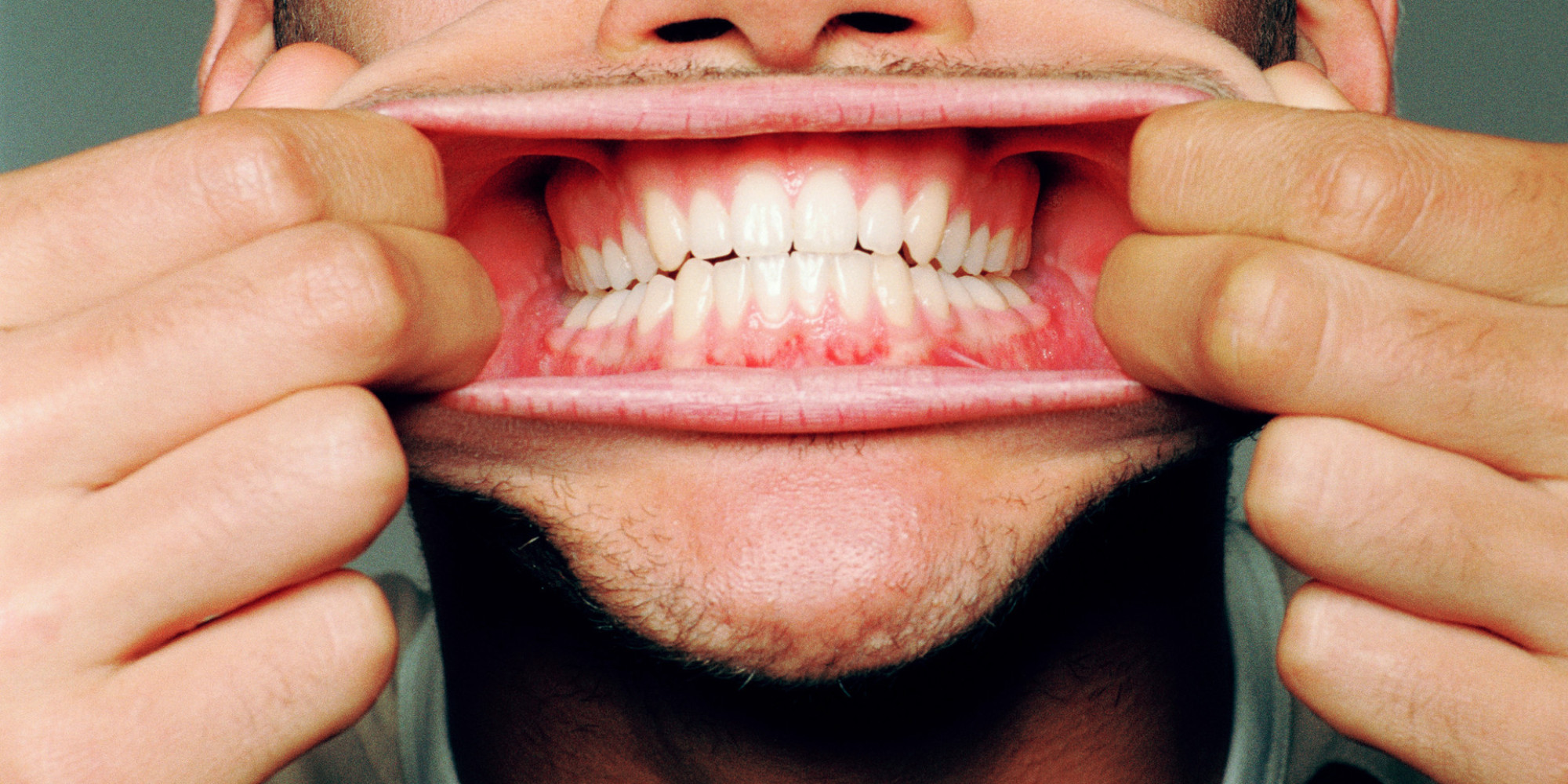 gum-disease-heart-disease-linked-in-new-study-huffpost