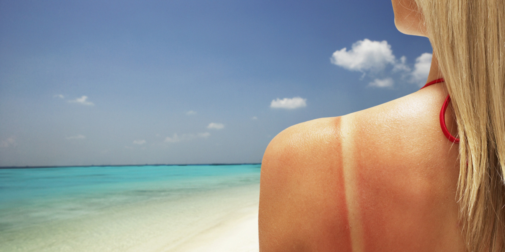 how to not get a sunburn at the beach