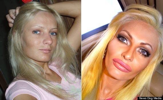 Model Spends Thousands On Plastic Surgery To Look Like A