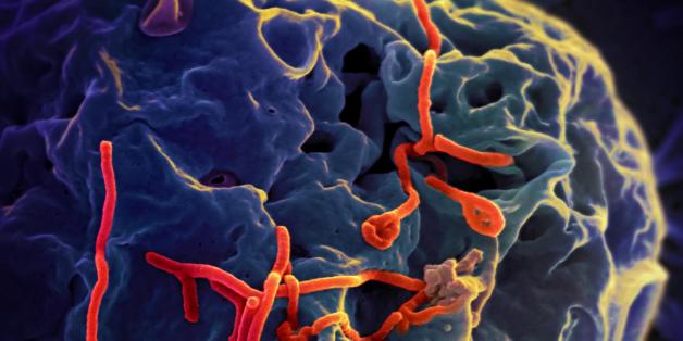 Représentation micrographique d'ebola sur une cellule