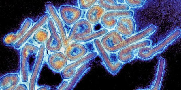 Marburg hemorrhagic fever (Marburg HF) is a rare, severe type of hemorrhagic fever which affects both humans and non-human primates. Caused by a genetically unique zoonotic (that is, animal-borne) RNA virus of the filovirus family, its recognition led to the creation of this virus family. The five subtypes of Ebola virus are the only other known members of the filovirus family.
Marburg virus was first recognized in 1967, when outbreaks of hemorrhagic fever occurred simultaneously in laboratories in Marburg and Frankfurt, Germany and in Belgrade, Yugoslavia (now Serbia). A total of 31 people became ill; they included laboratory workers as well as several medical personnel and family members who had cared for them. There were 7 deaths among the reported cases. The first people infected had been exposed to African green monkeys or their tissues. In Marburg, the monkeys had been imported for research and to prepare polio vaccine. In addition to the 31 cases, an additional primary case was retrospectively serologically diagnosed.
Content Credit: CDC
Photo Credit: Image courtesy of Dr. Tom Geisbert.
<a href="http://www.microbeworld.org" rel="nofollow">www.microbeworld.org</a>