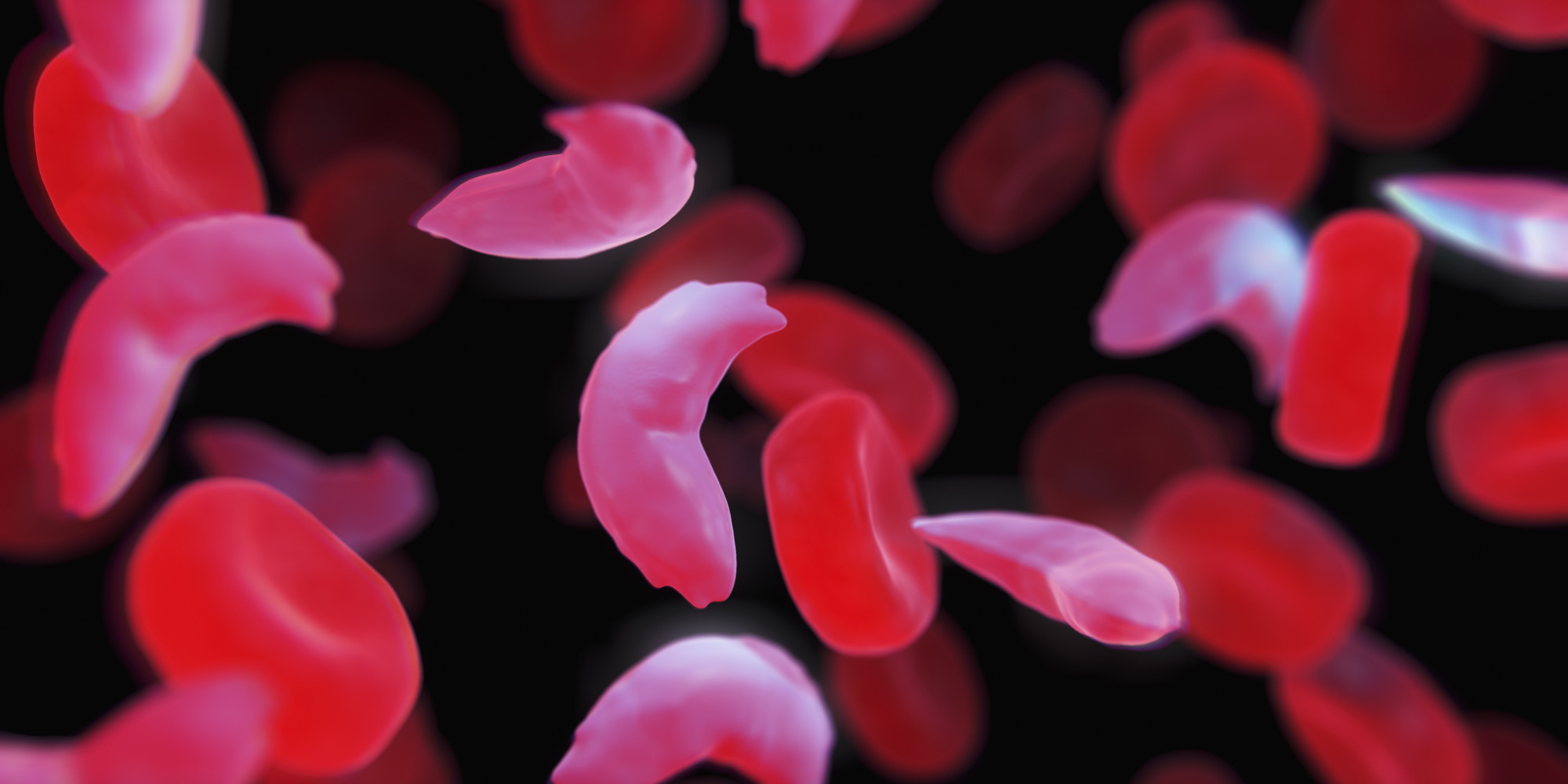 multiple-myeloma-drug-could-revolutionize-treatment-for-sickle-cell