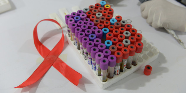 A Pakistani technician takes samples in a laboratory alongside a ribbon promoting the forthcoming World Aids Day in Islamabad on November 30, 2013. The World Health Organization have issued new recommendations to address the specific needs of adolescents both for those living with HIV and those who are at risk of infection. AFP PHOTO/Farooq NAEEM (Photo credit should read FAROOQ NAEEM/AFP/Getty Images)