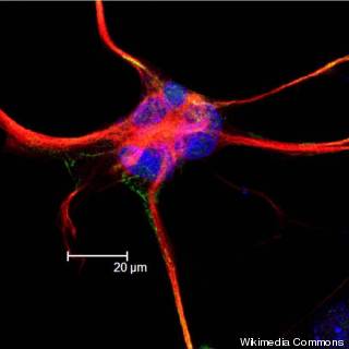 astrocyte