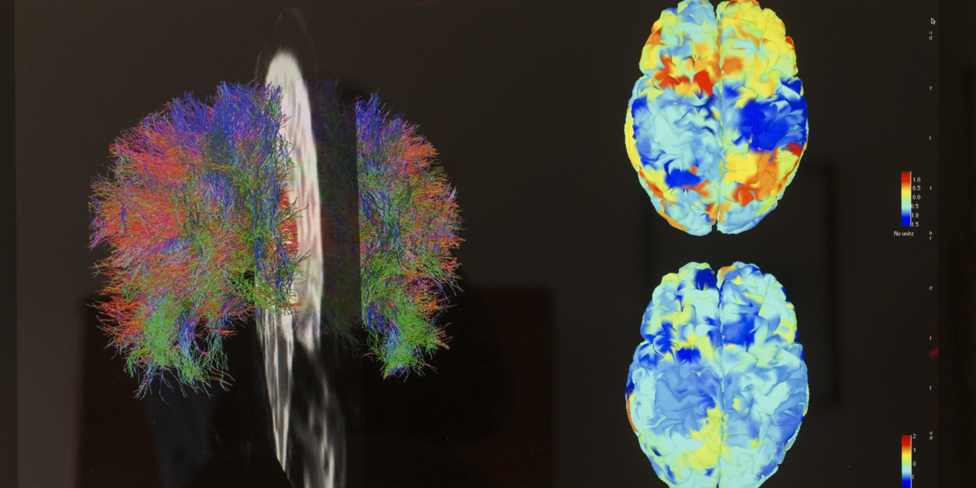 research papers regarding brain-based learning research papers regarding brain-based learning