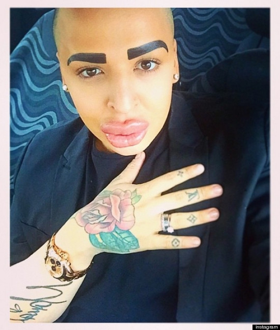 キム・カーダシアンになりたくて&mldr;整形手術に15万ドルも使った男 | HuffPost Japan