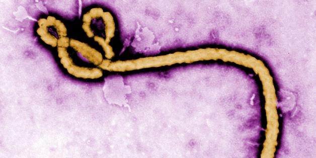 Created by CDC microbiologist Frederick A. Murphy, this colorized transmission electron micrograph (TEM) revealed some of the ultrastructural morphology displayed by an Ebola virus virion. See PHIL 1181 for a black and white version of this image.
What is Ebola hemorrhagic fever (Ebola HF)?
Ebola hemorrhagic fever (Ebola HF) is a severe, often-fatal disease in humans and nonhuman primates (monkeys, gorillas, and chimpanzees) that has appeared sporadically since its initial recognition in 1976.
The disease is caused by infection with Ebola virus, named after a river in the Democratic Republic of the Congo (formerly Zaire) in Africa, where it was first recognized. The virus is one of two members of a family of RNA viruses called the Filoviridae. There are four identified subtypes of Ebola virus. Three of the four have caused disease in humans: Ebola-Zaire, Ebola-Sudan, and Ebola-Ivory Coast. The fourth, Ebola-Reston, has caused disease in nonhuman primates, but not in humans.
For more information on Ebola and what CDC is doing, please visit: <a href="http://www.cdc.gov/vhf/ebola/index.html" rel="nofollow">www.cdc.gov/vhf/ebola/</a>
