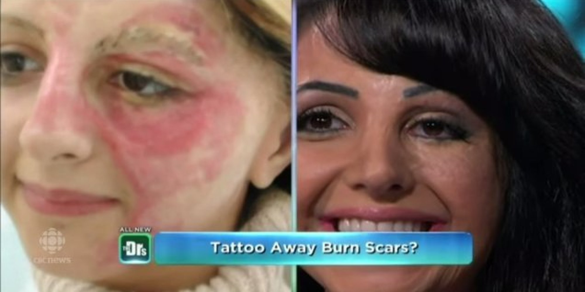 Woman Tattoos Her Own Face To Cover Scars, Starts Business 