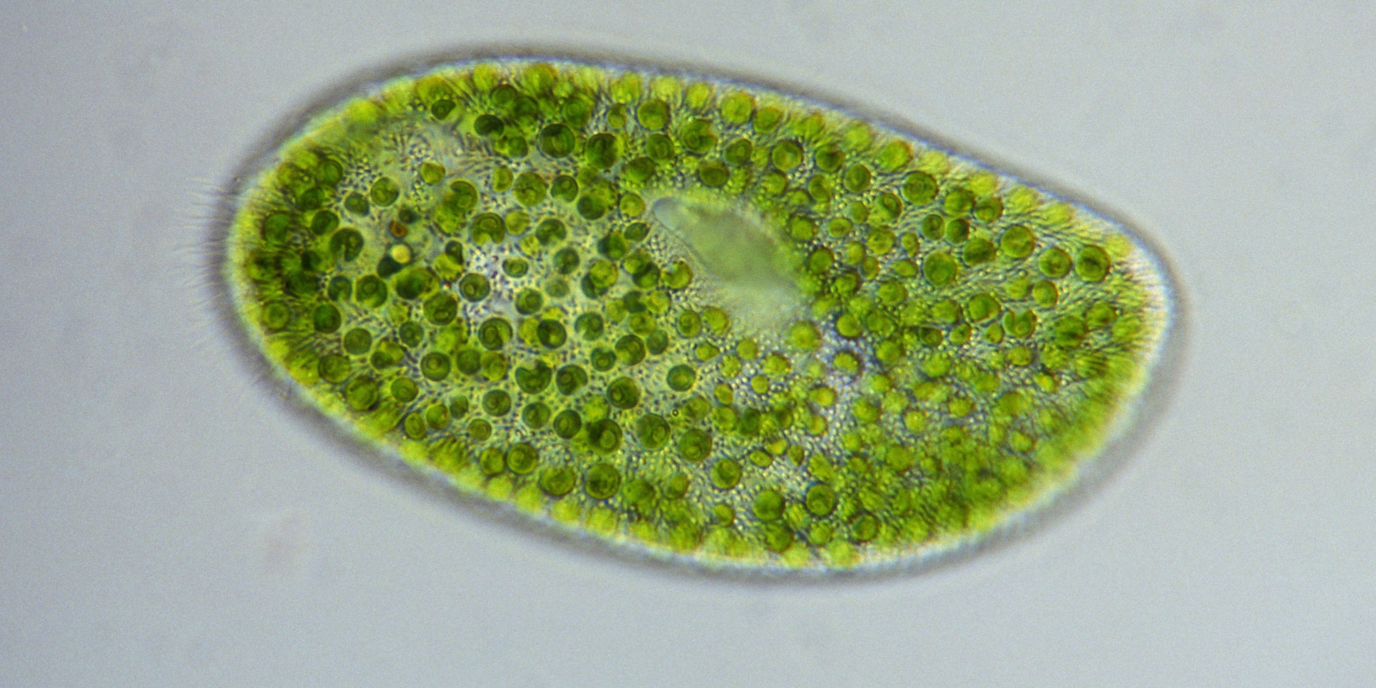 What Is Chlorella  Health Benefits Of The Green Algae  
