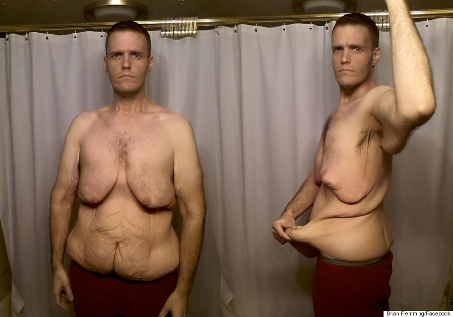 Fat loss ayurvedic oil photo 4