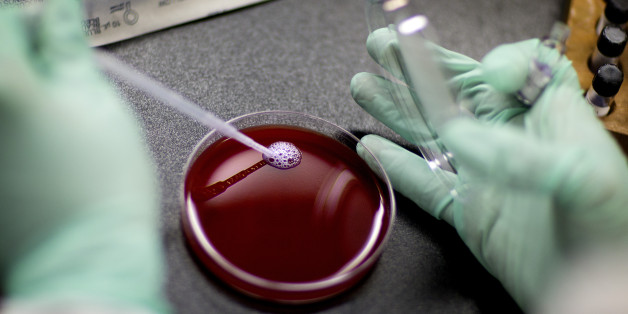 Microbiologist Johannetsy Avillan adds samples of a bacterium to a blood plate in an anaerobe lab within the Infectious Disease Laboratory at the federal Centers for Disease Control and Prevention, Monday, Nov. 25, 2013, in Atlanta. (AP Photo/David Goldman)
