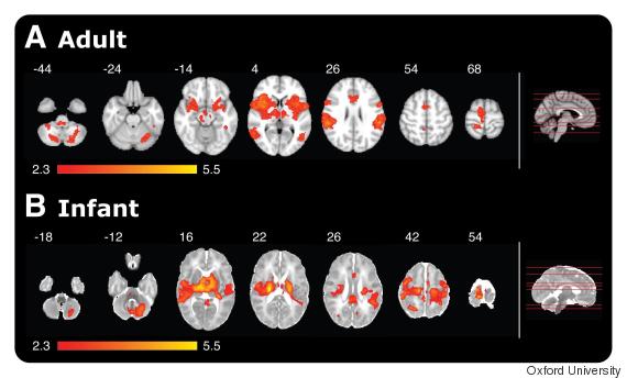 MRI Scans Show Babies Are More Sensitive To Pain Than Adults | HuffPost UK