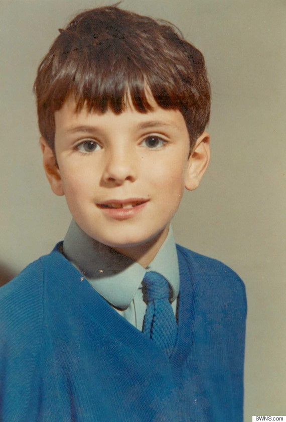 Man Suffers 'Hay Fever' And Blocked Nose For 44 Years, Sneezes Out Toy Dart He Inhaled In The '70s