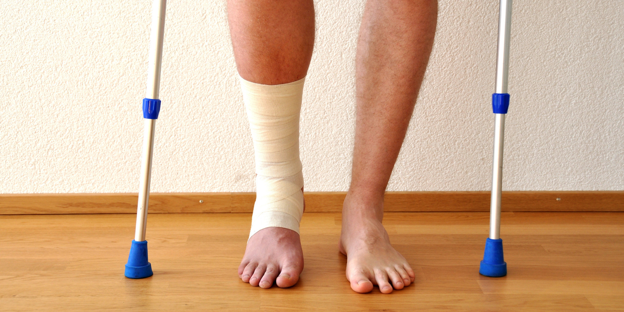 so-you-broke-a-bone-now-what-huffpost