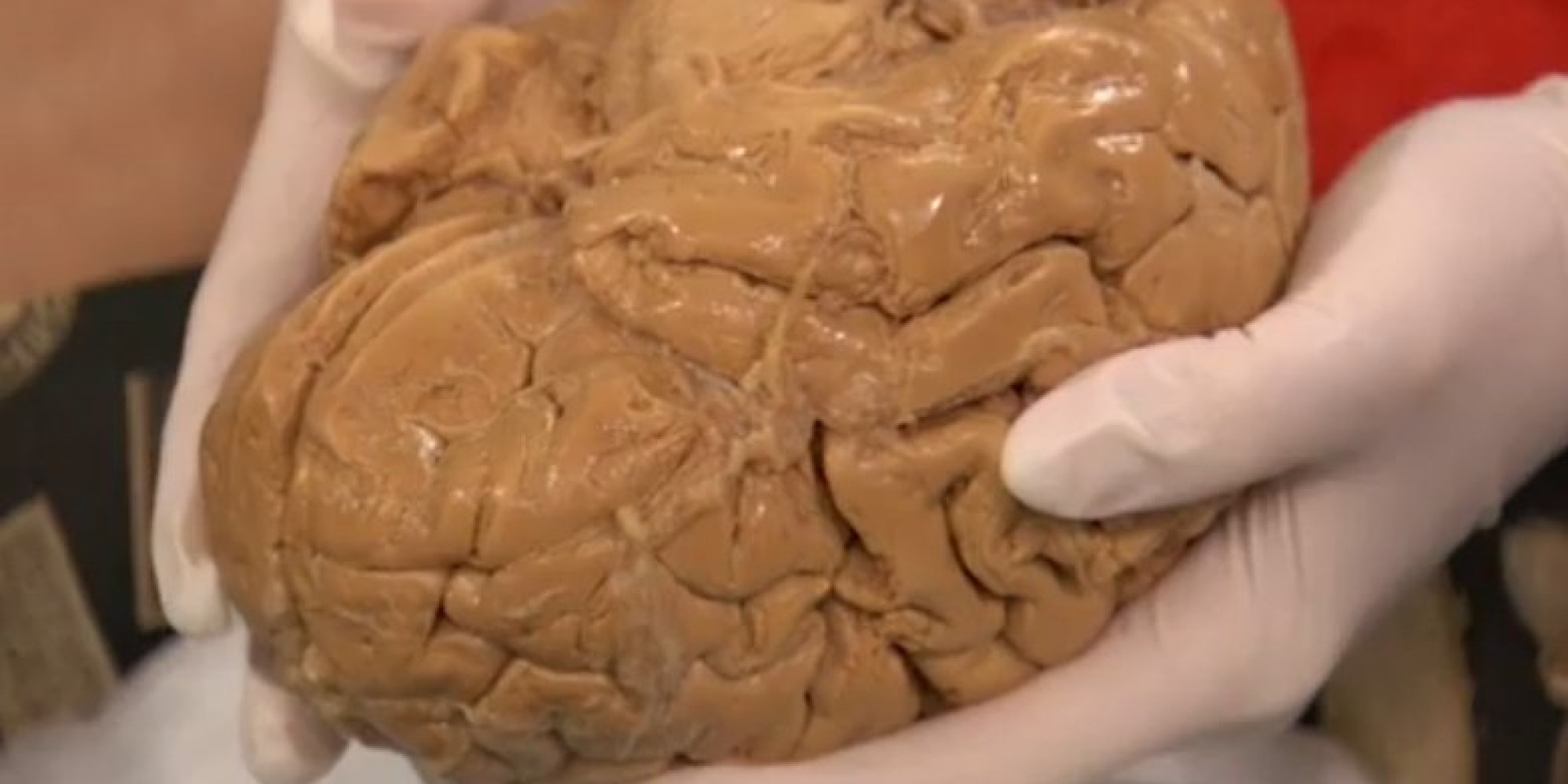 WATCH: Get An Up-Close Look At A Real Human Brain | HuffPost