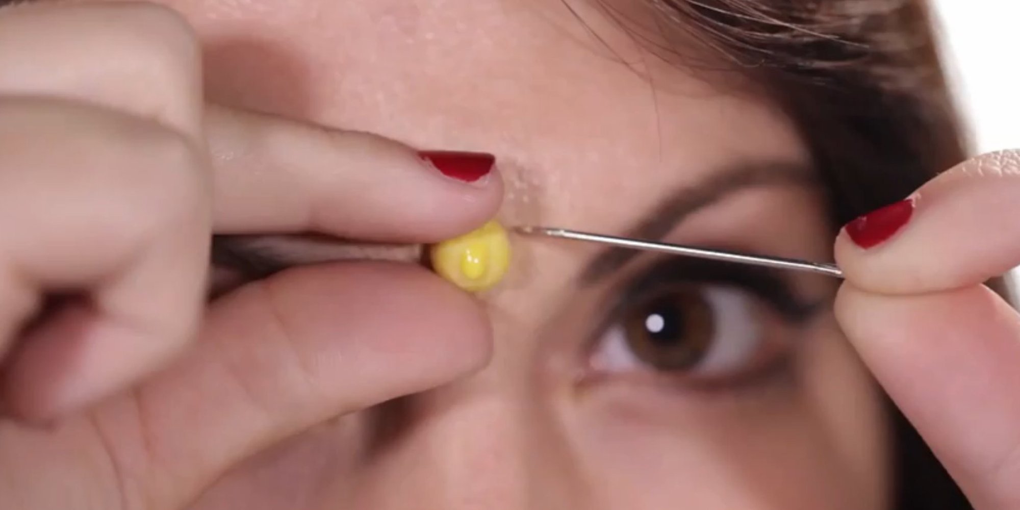 How To Pop A Spot Properly A Step By Step Guide For Tackling Zits 