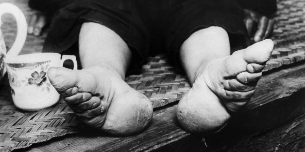 The national government at Nanking is now trying to stamp out "bound feet" which has caused women and children misery for a great number of years. Chinese women attempt to make their feet smaller by binding them in childhood. This is a Sept. 21, 1936 photo. (AP Photo)