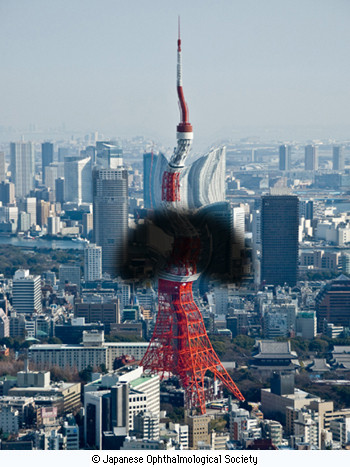 momaku