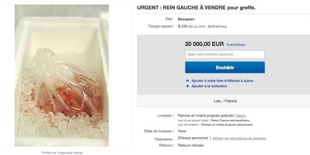 Vends rein gauche sur Ebay pour faire parler de la journée mondiale du don d'organe
