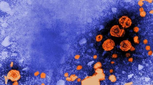 hepatitis