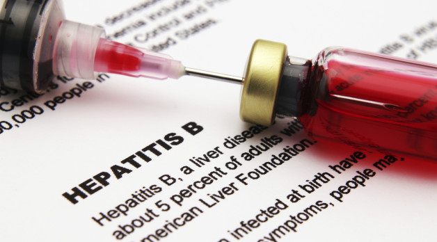 hepatitis